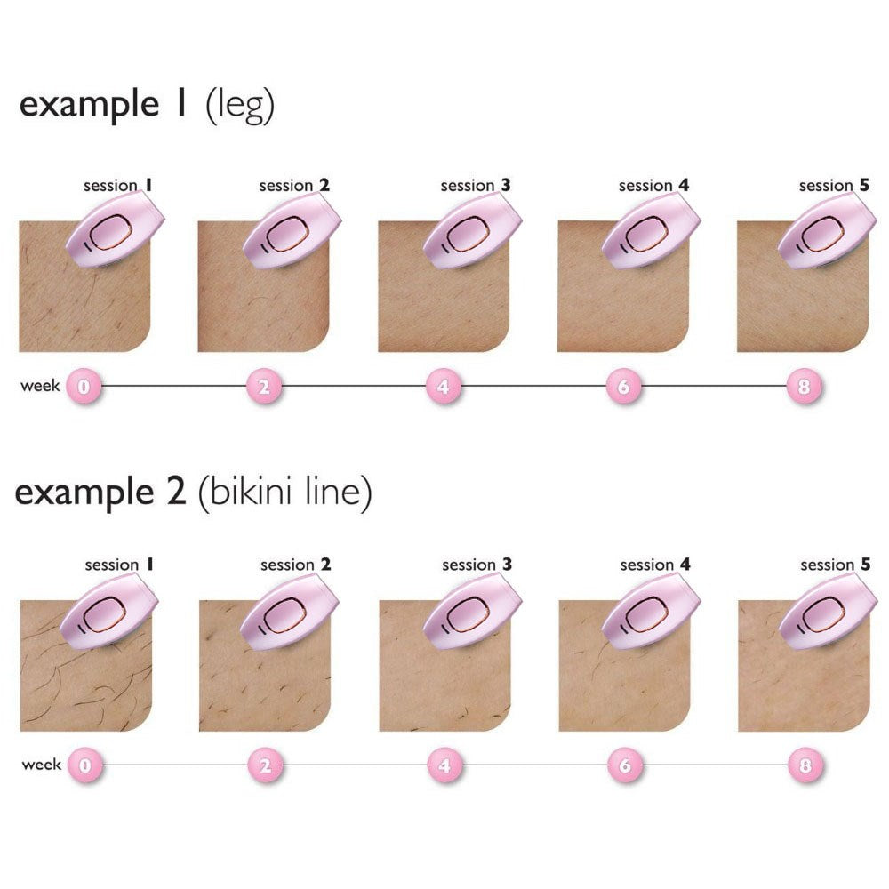 500000 Trwałe, bezbolesne urządzenie do depilacji laserowej IPL miga do całego ciała PK