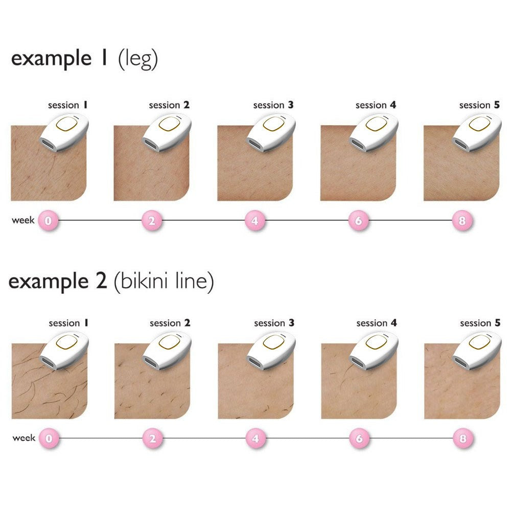 IPL laserski odstranjevalec las ročni sistem za odstranjevanje las brez bolečin 500000 generičnih bliskavic